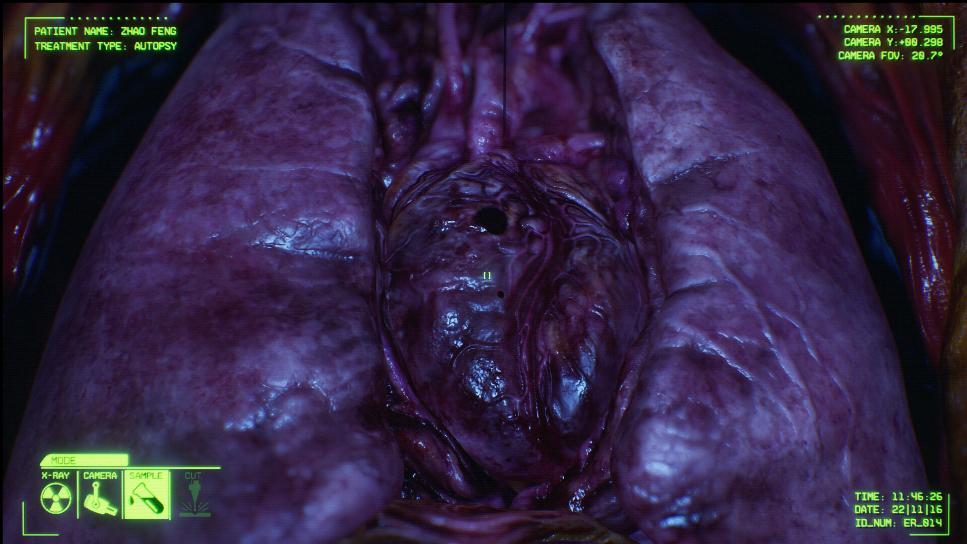 Negative Atmosphere: Emergency Room screenshot screenshot 5