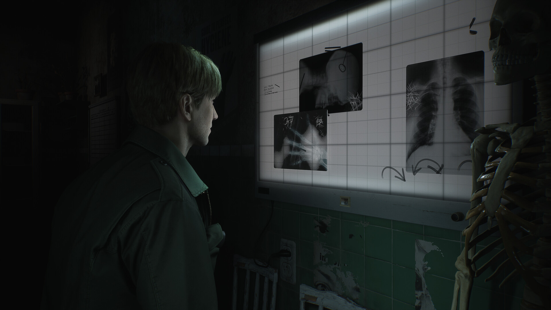 Silent Hill 2 enhanced edition's latest update adds stable 60fps