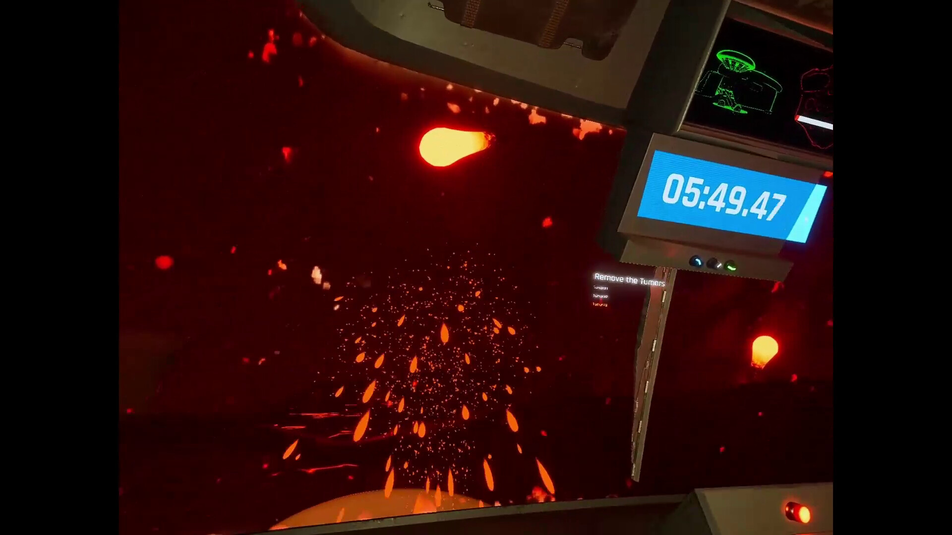 Marion Surgical Robot Game #0