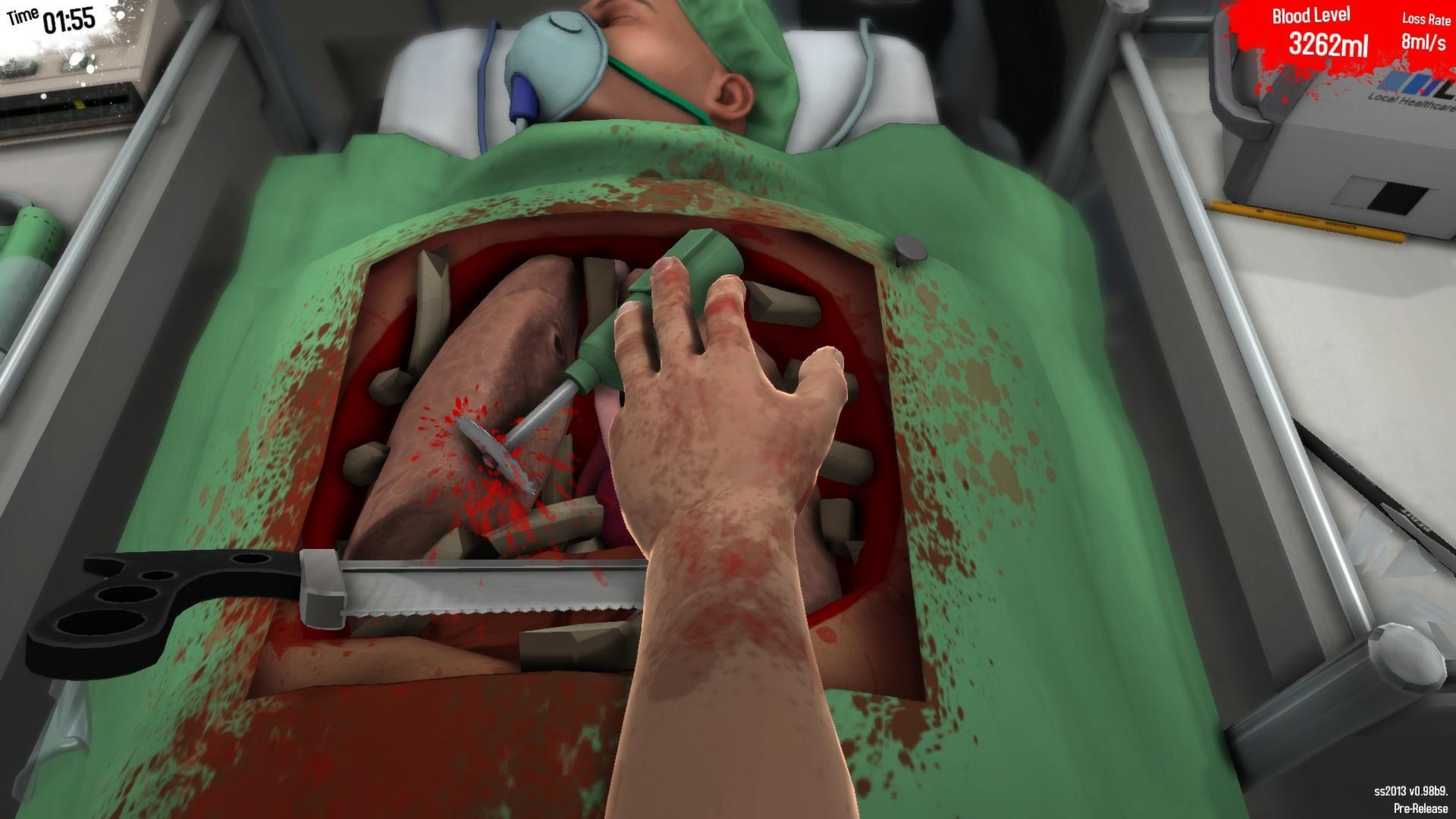 Surgeon Simulator 2013. Нервы, операций и кровь