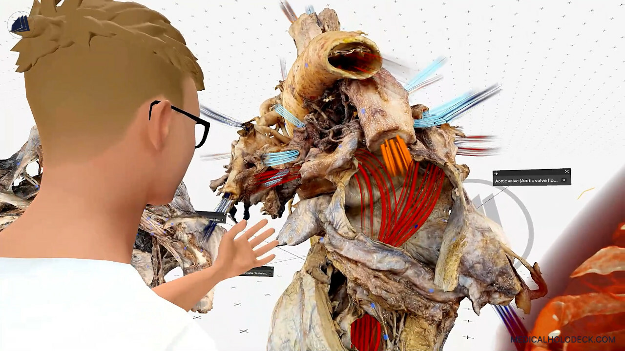 Medicalholodeck. Anatomy, Medical Imaging (DICOM), and Automatic Segmentation in VR and AR. For Medical Education and Professionals. screenshot thumbnail screenshot 2