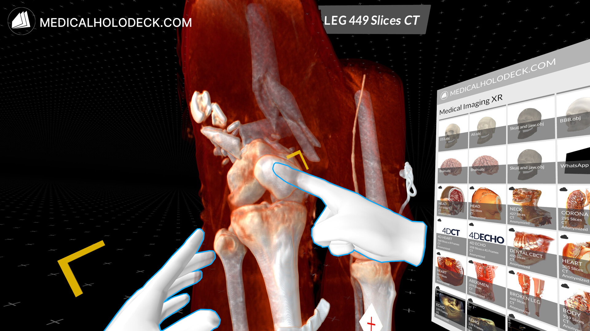 MEDICALHOLODECK. Surgical Planning, Automatic Segmentation, Simulation and Medical Education in Virtual and Augmented Reality. Digital Twins, Medical Imaging, and Anatomy Atlas for Healthcare and Education. screenshot screenshot 1