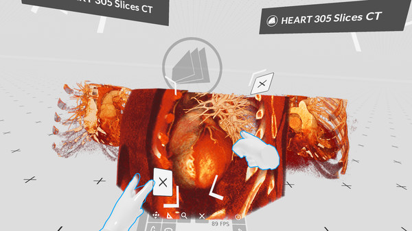 【图】MEDICALHOLODECK. The medical DICOM Viewer and Human Anatomy Lab in Virtual Reality.(截图3)