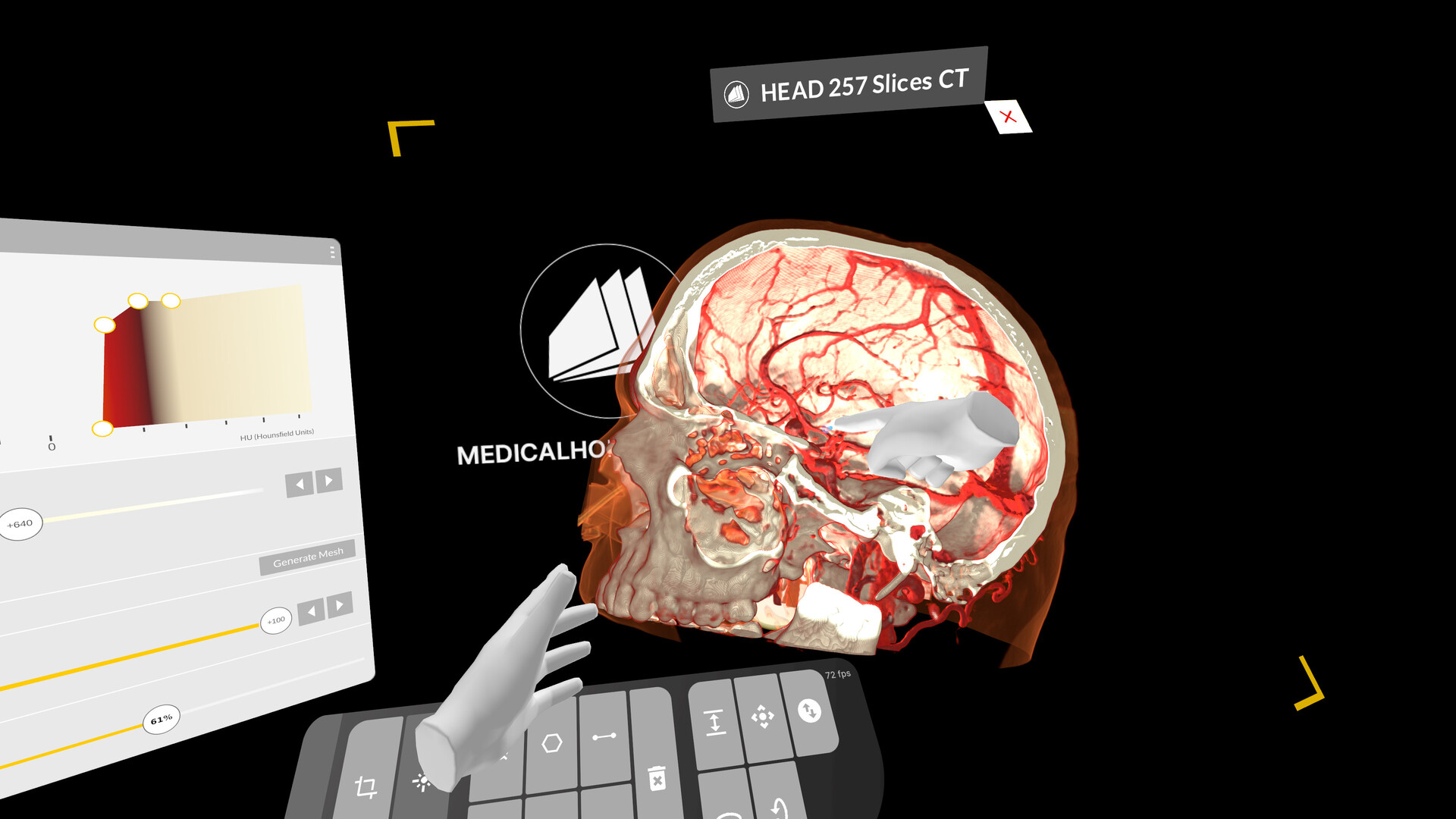 MEDICALHOLODECK. Surgical Planning, Automatic Segmentation, Simulation and Medical Education in Virtual and Augmented Reality. Digital Twins, Medical Imaging, and Anatomy Atlas for Healthcare and Education. screenshot thumbnail screenshot 5