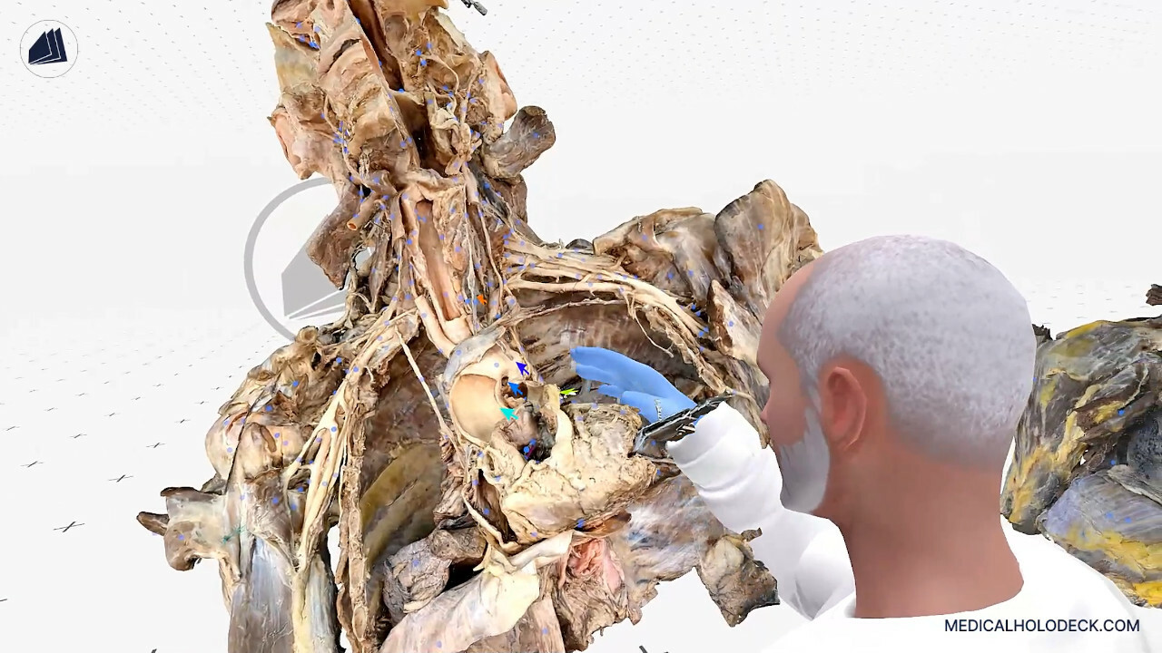 MEDICALHOLODECK. Surgical Planning, Automatic Segmentation, Simulation and Medical Education in Virtual and Augmented Reality. Digital Twins, Medical Imaging, and Anatomy Atlas for Healthcare and Education. screenshot screenshot 7
